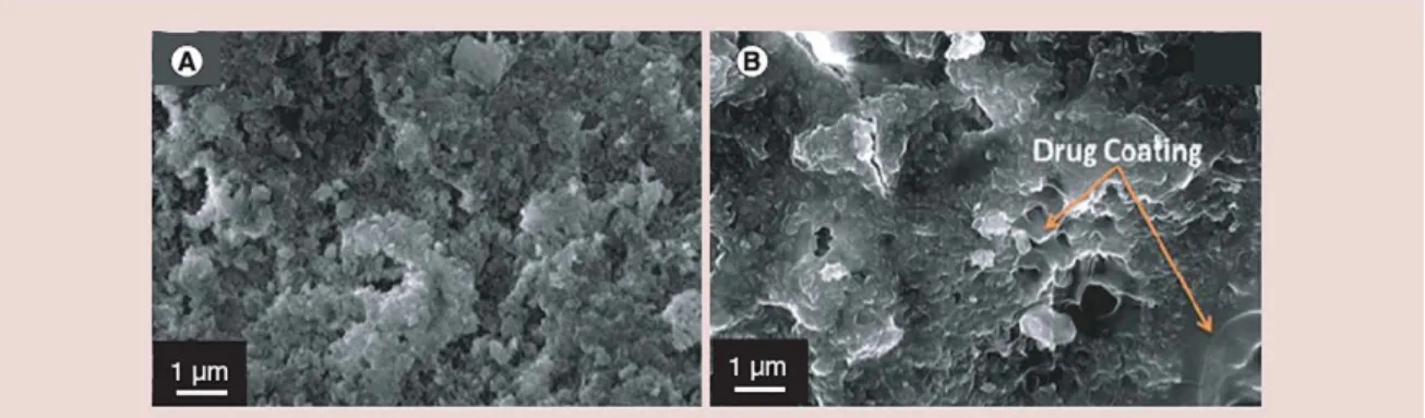 Figure 3. (A) Hydrothermal converted coralline hydroxyapatite surface. (B) Gentamicin-coated coralline hydroxyapatite surface