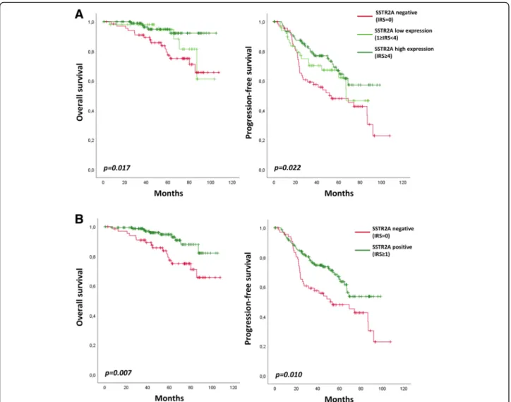 Fig. 4 Overall survival and Progression-free survival according to SSTR2A protein expression in anaplastic oligodendroglioma, IDH -mutant and 1p/19q-codeleted
