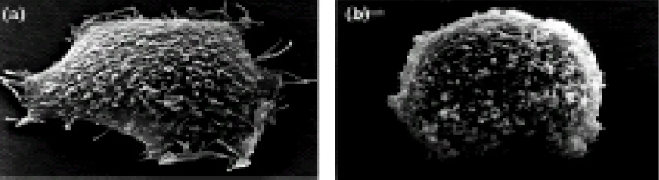Fig 2 Morphology of (a) PC12 wild type and (b) anti-sense-Dp71 cells by scanning electron  microscopy.