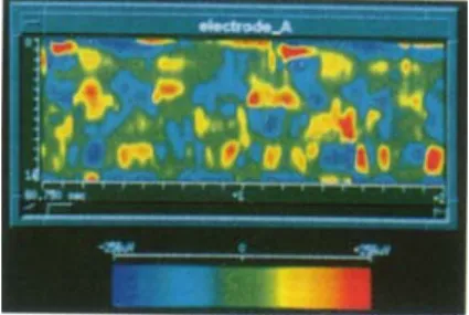 Fig. 5. A space-time map of SEEG signals  