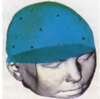 Fig. 8. 3D surface cartography (EEG)  
