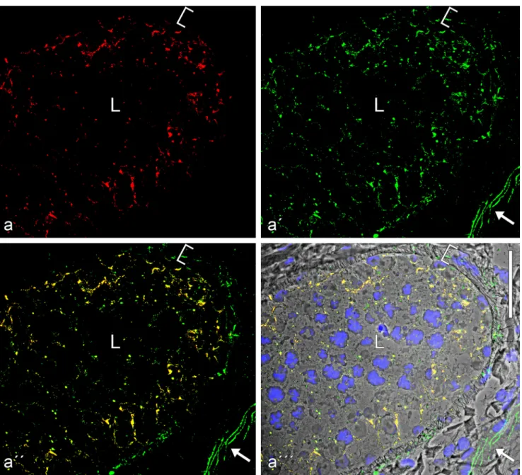 Fig. S6). The same seems to be true for the neurofilament bundles (see also Davidoff et al