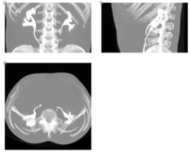 Fig. 1.  MIPs of the excretory urography. 