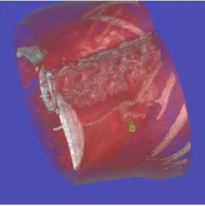 Fig. 9 Surface rendering with the projection of the anatomical  landmarks (pelvis, spine and ribs)