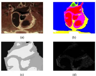 Figure 1. Images used for evaluation. Left atrium and pul- pul-monary veins phantom images: cryosection of male human thorax (a); segmented and labeled into six different types of tissues (b); corresponding simulated CT (c) and US (d) images.