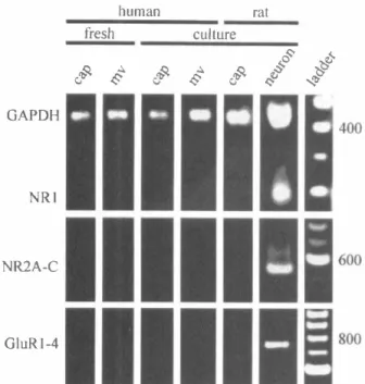 FIG. 5.  RT-PCR products from mRNA extracted from freshly iso­