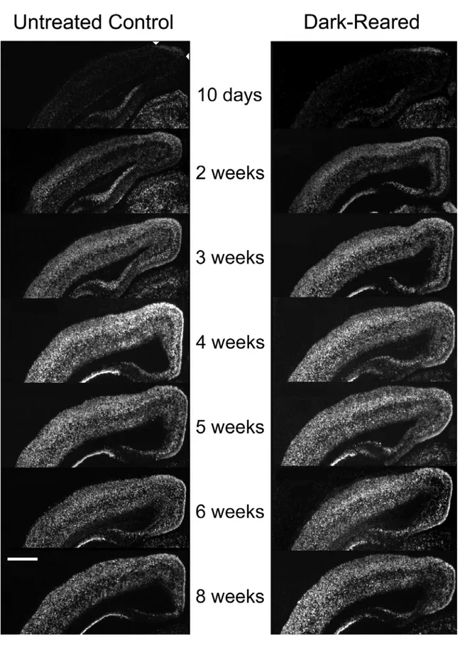 Figure 2-2. Developmental time course of cpg15 expression in the visual cortex of normal and DR  rats