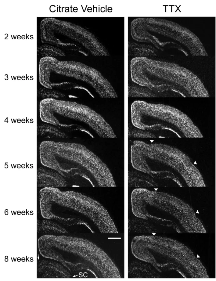 Figure 2-5. cpg15 expression in visual cortex after 3 days of monocular TTX blockade initiated at  different developmental times