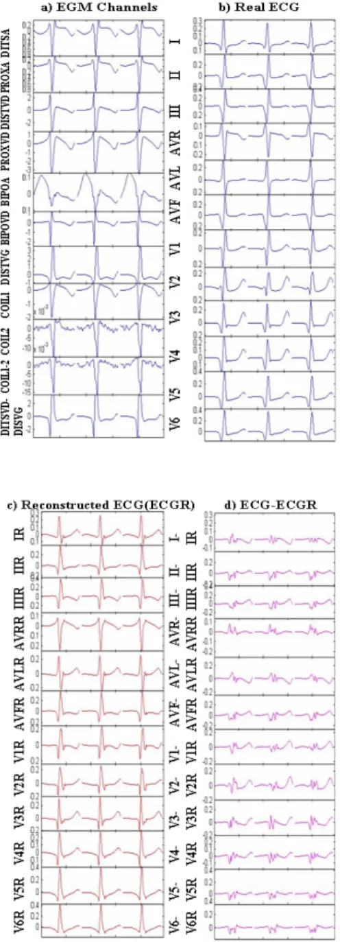 Fig. 4. The correlation coefﬁcient, obtained for P2, between ECG an ECGR for each hearbeat.