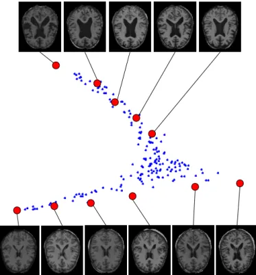 Figure 2: LEM embeddings using MR images regis- regis-tered with affine transformations and a global brain mask (218 images, input dimension: 23346, target  di-mension: 2)