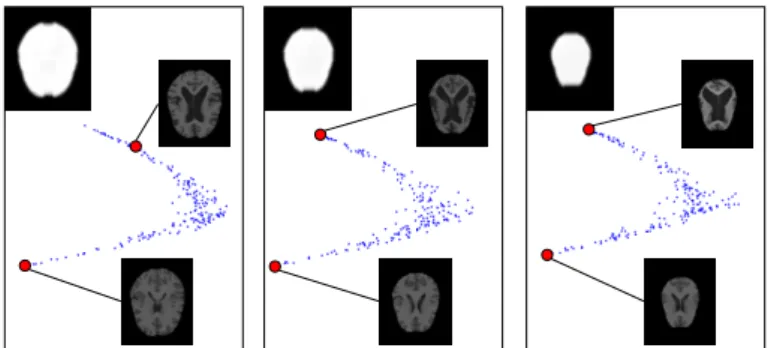 Figure 3: LEM Embeddings using MR images (reg- (reg-istered using affine transformations) and global brain masks more and more eroded (218 images, target  di-mension: 2)