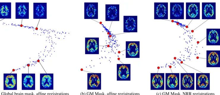 Figure 4: LEM embeddings in dimension 2 using PiB images.