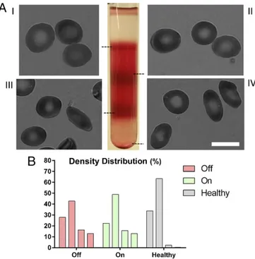 Fig. 1. Optical measurement of morphological properties of RBCs. Mor- Mor-phological information about the sample (eccentricity, surface area, and volume) can be obtained from deformations of the optical wave front after its traversal through RBCs