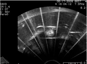 Figure 9 : B-Scan and M-Scan  images of localized  cavitation within test tube  