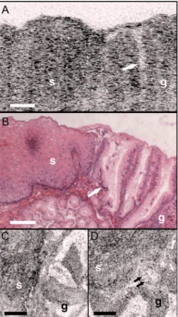 Figure 6 shows UHR OCT and OCM images of normal colon in the region of the cecum. Crypt architecture can be 
