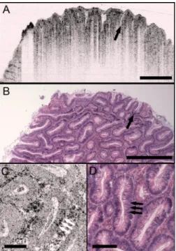 Fig. 7 Tubular adenoma. 共 a 兲 UHR OCT image. Crypt architecture with distinct epithelial lining is identified