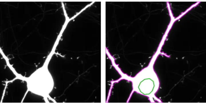 Fig. 2. Fluorescence microscopy image of a neurone in culture (image size: 400×400). Left: original image