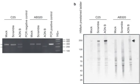 Fig. 1 Validation of exon skipping by RT-PCR and western blot control cell line (C25) and patient-derived cell  line were transfected with a specific AON, a scrambled AON or without AON (Mock) before analysis by RT-PCR  (panel a) for the presence of skippe