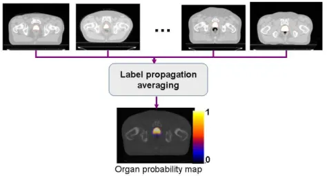 Figure 11. Generation of organ probability maps by propagating labels into the  common template 