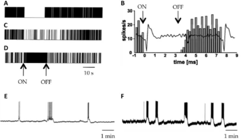 Fig.  2.  Electrophysiological  effects  of  STN-HFS  at  local  level.  Raster  displays  (A,  C  and  D)  and filter analogue recordings (B) representing a typical example of complete ( A and B ) and  partial inhibition ( C ) or of excitation (D) in STN 