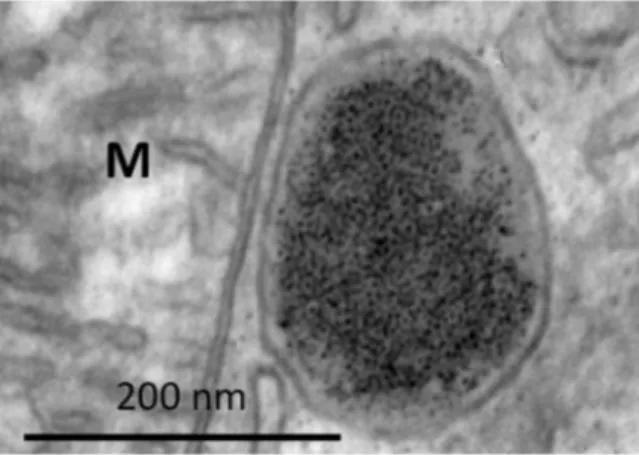 Figure 4. Representative transmission electron micrograph exemplifying an endosome within the  cytoplasm of a cell