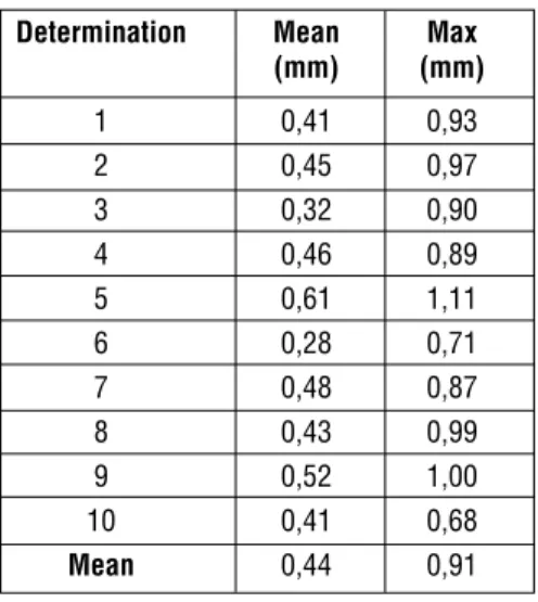 Table 1 : Distances computed of zygomatic surface registered in DZF referential to the same surface registered in DRF referential.