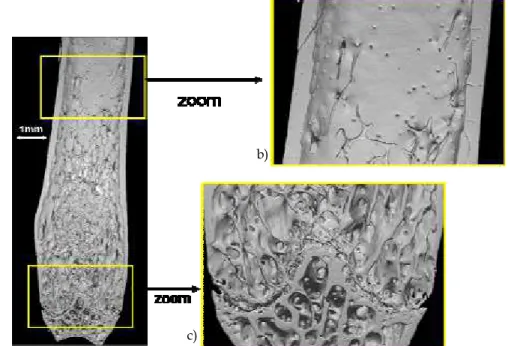 Fig. 1. a) SR micro-CT image of a mice bone; b) zoom on the cortical envelope; c) zoom on  the trabecular part of the bone 