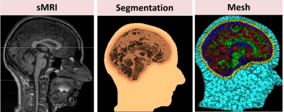 Fig. 9 The different steps of preprocessing in discretizing realistic head volume using FEM
