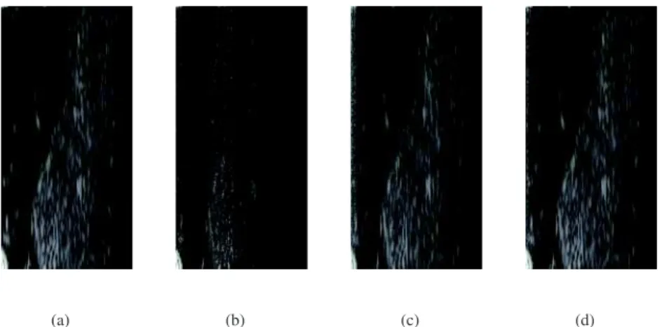 Fig. 2. Reconstruction results for a thyroid ultrasound image using 33% of the number of samples in the original