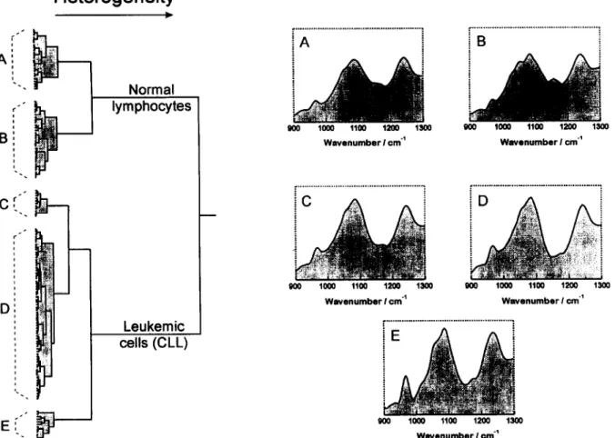 Fig.  3.  Dendrogram  representation  of  normal  lymphocytes  and  CLL  cells,  created  by  cluster  analysis  of  first  derivative  spectra  in  the  900-  1300  cm-’  region
