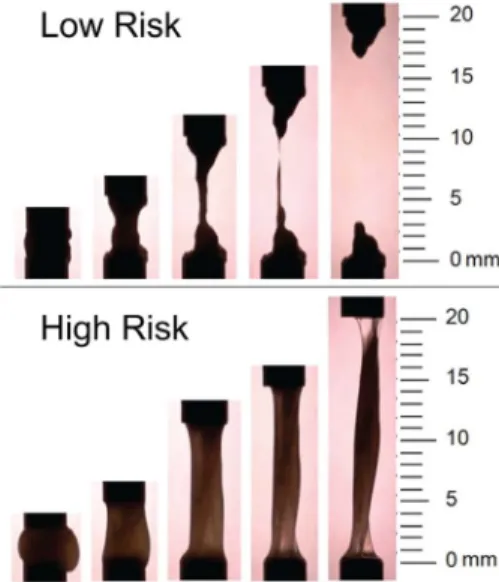 Figure 2. Example time series of spinnbarkeit test at 2, 5, 10, 15, and 20 mm in low-risk and high-risk cervical mucus samples