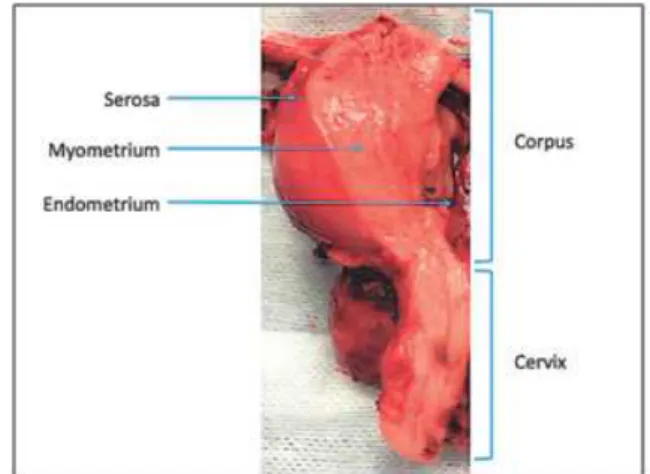 Fig. 1. Uterus specimen demonstrating successive layers of the wall.