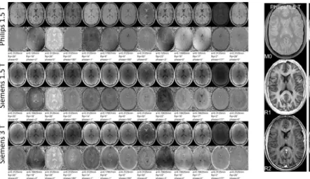 Figure 2: Reconstructed  proton density M0 map  (with remaining coil sensitivity profile weighting,  first row), corrected from receiver coil profile  inhomogeneity for Philips 1.5 T, non-corrected for  Siemens 1.5 T and 3 T, R 1 and R 2 maps displayed  wi