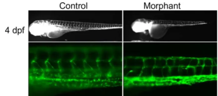 Figure 1 Zebrafish knockdown results in lymphatic developmental defects.