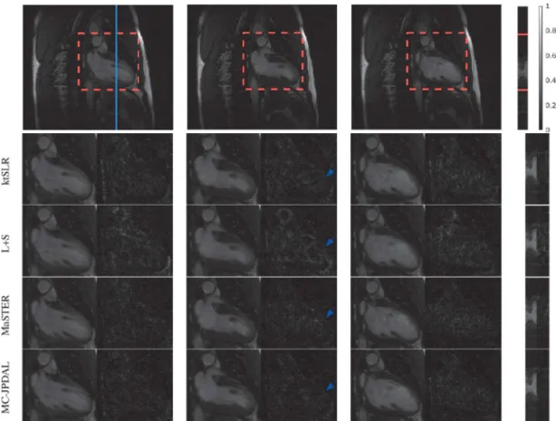Fig. 7. Reconstruction of the two-chamber MRI scan using different algorithms: frames 3, 10, 14 and the temporal profile (left to right)