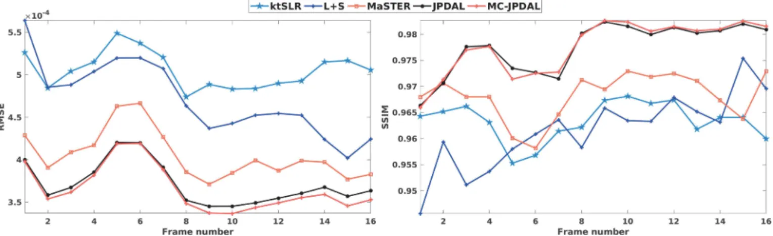 Fig. 8. Quantitative comparison of the two-chamber MRI sequences using the algorithms: ktSLR, L+S, MaSTER, the proposed JPDAL and MC-JPDAL