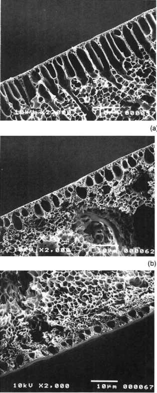 Figure  2  SEM micrographs of membrane cross sections  of  different  polymer  concentrations:  (a) 15  wt  %;  (b)  20  wt  %;  (c) 25  wt  %