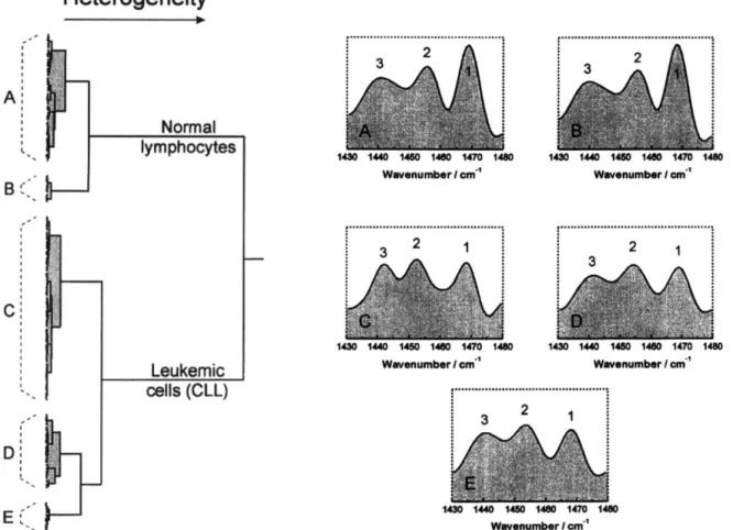 Fig.  3.  Dendrogram  representation  of  normal  lymphocytes  (23  individuals)  and  chronic  lymphocytic  leukemic  cells  (38  patients)  created  by cluster  analysis  of first  derivative  spectra  between  1430  and  1480  cm -  ’  after  area  norm