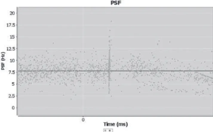 Figure 6 An example peristimulus frequencygram (PSF diagram) for the soleus muscle single motor unit pathway.