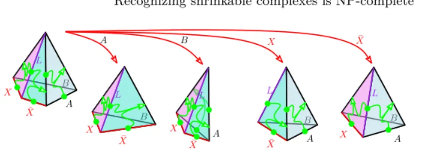 Fig. 4. The variable gadget: realization (left) and various edge contractions.