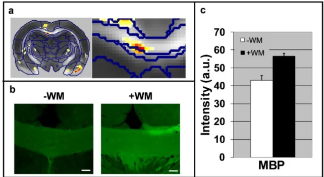 Figure 8: White matter plasticity following a 5-day water maze. (a) Statistical parametric  maps of interaction in FA values between scan time (pre vs