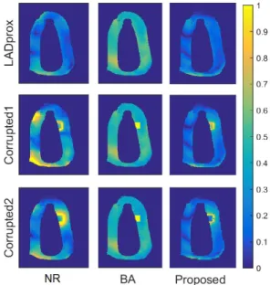 Fig. 9. Weights for two examples of in vivo images obtained for two different patients