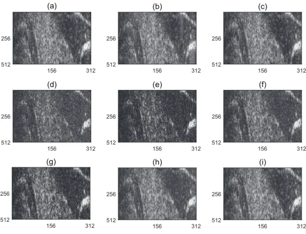 Fig. 4: (a) Original US RF image, Reconstructed images with (b) IRLS, (c) D-AMP, AMP-based algorithm (d)-(e) in image domain with ST and ABE denoiser, (f)-(g) in wavelet domain with ST and ABE denoiser, (h)-(i) in DCT domain with ST and ABE denoiser.