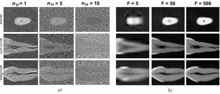Fig. 6. Effect of the iteration number it and the tensor rank F in the reconstructed images