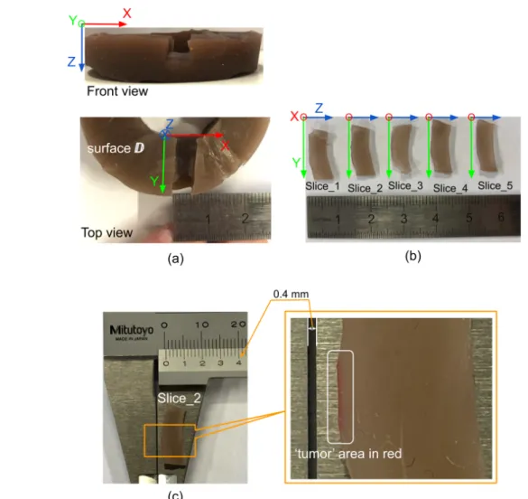 Fig. 12 Analyzing how deep the 'tumor' inltrating into surface D using a vernier scale