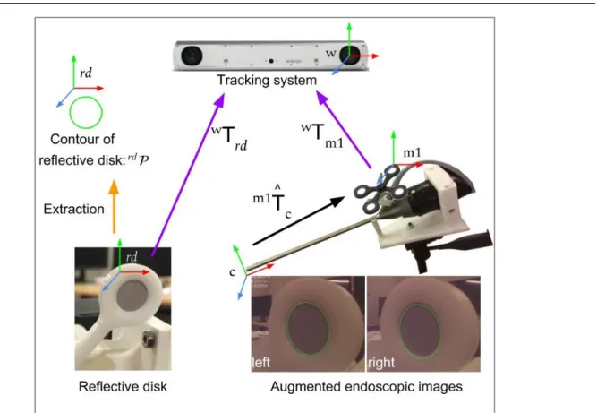 Fig. 6 Evaluating the hand-eye calibration solution m1 T b c by projecting the reective disk contour on the endoscopic images