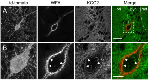 Figure 1. KCC2 labeling of hippocampal CA1 parvalbumin interneurons.  