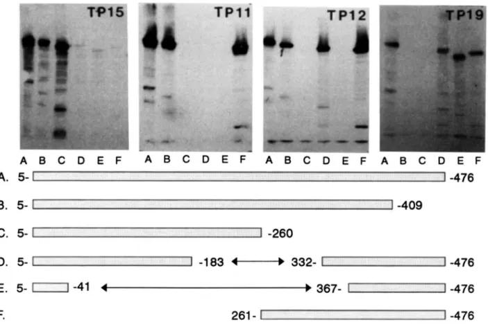 Fig.  1.  Reactivity of mAbs TP15,  TPl1. TP12, and TP19  with fragments of CETP expressed  as  Bgalactosidase fusion proteins