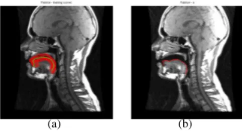 Fig. 1. An example of the mid-sagittal image and con- con-tours. (a): all the contours in the training set (red lines) and their mean contour (green line); (b): the mid-sagittal image of M 0 ’s sound [a] and its tongue contour drawn manually (red).