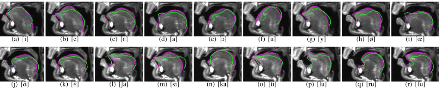 Fig. 2. Results on M 1 ’s mid-sagittal images. Green curve: initial contour; magenta curve: final result obtained using our model.